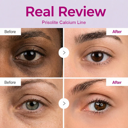 🔥LAST DAY 50% OFF!! Prisolite Korean Calcium Dark Spot Eye Cream