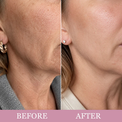 🦢Neck Wrinkle Eraser! Built-In Gua Sha Cream w/5% Anemarrhena Root Complex + PDRN Korean Skincare