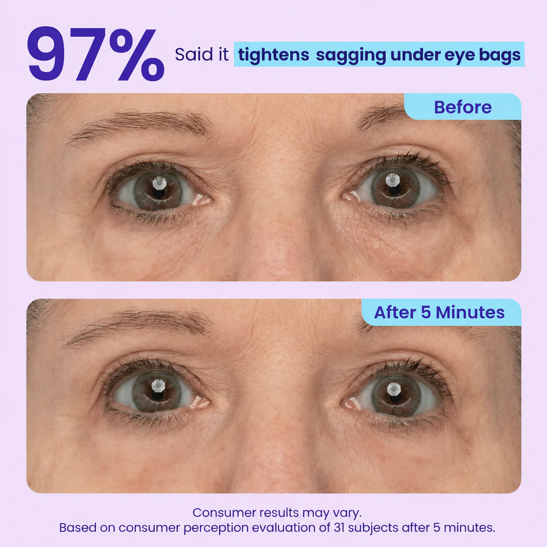 Prisolite™ Instant Eye Tightener - Tightens, Firms, & Blurs Wrinkles