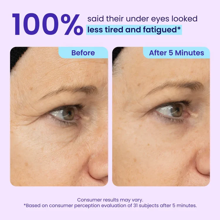 Prisolite™ Instant Eye Tightener - Tightens, Firms, & Blurs Wrinkles