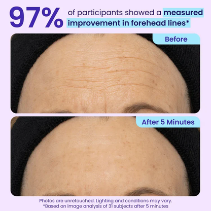 Prisolite™ Instant Eye Tightener - Tightens, Firms, & Blurs Wrinkles
