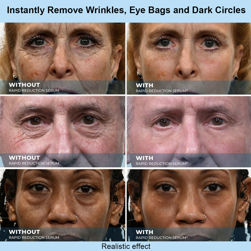 Prisolite™ Instant Face Temporary Tightener – Instant visible results in 30 seconds
